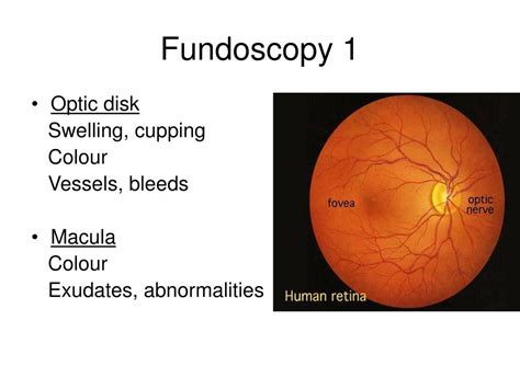fundoscopy findings|fundoscopy technique.